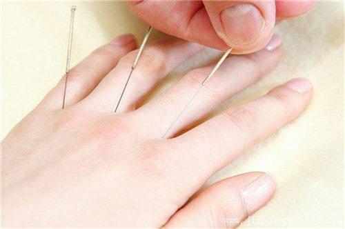 针灸真的没有副作用吗,针灸不对症有什么危害