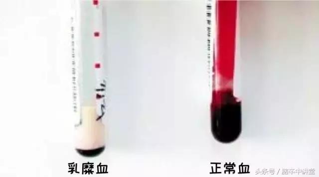 脂肪血是什么引起的,体检抽血是脂肪血什么原因