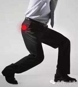 容易误诊成股骨头坏死的疾病,磁共振股骨头坏死有没有可能误诊