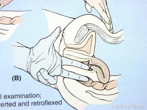 生孩子要十指全开吗,生小孩开一指到十指有多痛