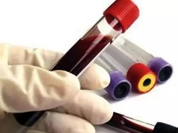 血常规指标解读,狗狗血常规指标解读