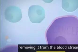 肺癌晚期医生下病危通知能活多久,肺癌晚期从发现到死亡1年半