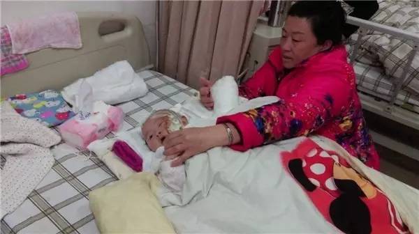 天!福州5个月宝宝被烧成这样!治疗费愁苦了父母,帮帮她吧!