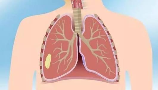 因肺结核死掉的名人,林徽因肺结核晚期的遗言