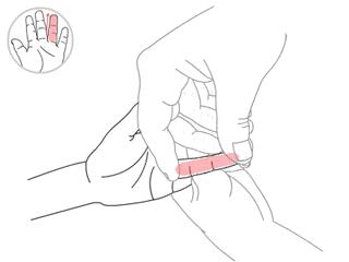 怎么判断宝宝咳嗽是肺热引起,宝宝肺热引起咳嗽怎么办