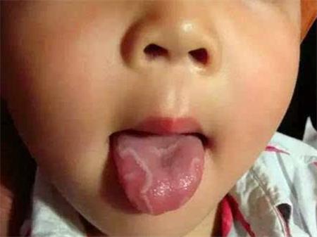 一周岁宝宝怎么预防口腔疾病,孩子的口腔健康要从小呵护