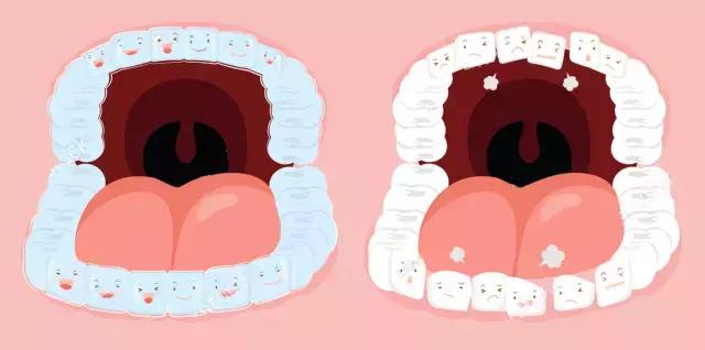 智齿导致旁边牙齿龋齿,智齿有龋齿有必要修补吗