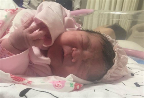 顺产八斤巨大儿案例,第一胎8斤的胎儿可以顺产吗