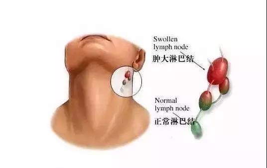 身边的12种致命毒素,八大症状暗示你体内毒素超标