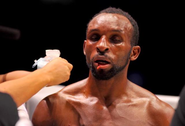 黑人拳王傲慢瞧不起中国武术，结果被19岁小将一招就把嘴唇踢裂