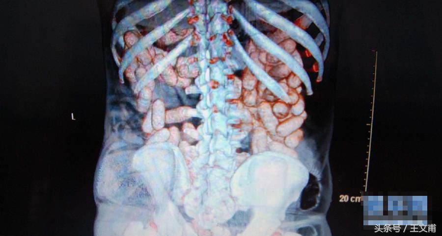 看看这些丧心病狂的“栽赃”！别一不小心就成了“毒贩”！