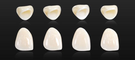 牙齿变白最有效的方法,想让牙齿变白做什么项目好