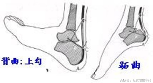 颈椎骨质增生最好的锻炼恢复方法,腰椎2至4节骨质增生应该怎样锻炼