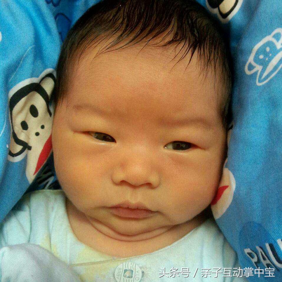宝宝满月黄疸还没退去？不妨试试这招，效果立竿见影！