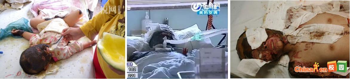 洁厕灵的危害有多可怕,洁厕灵会引起哪些反应