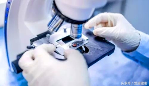 为什么现在那么多年轻人高血脂症,高血脂的常见误区