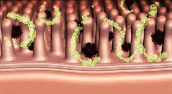 怎样排毒最好,肠道排毒说说
