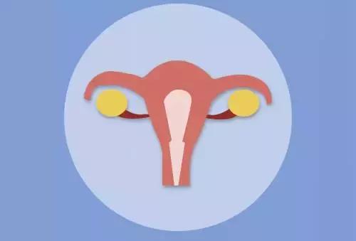 哎呀嘛，咔咔的！输卵管梗阻