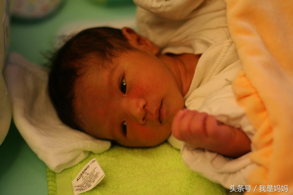 宝妈们的烦恼：黄疸出没该怎么办哪？