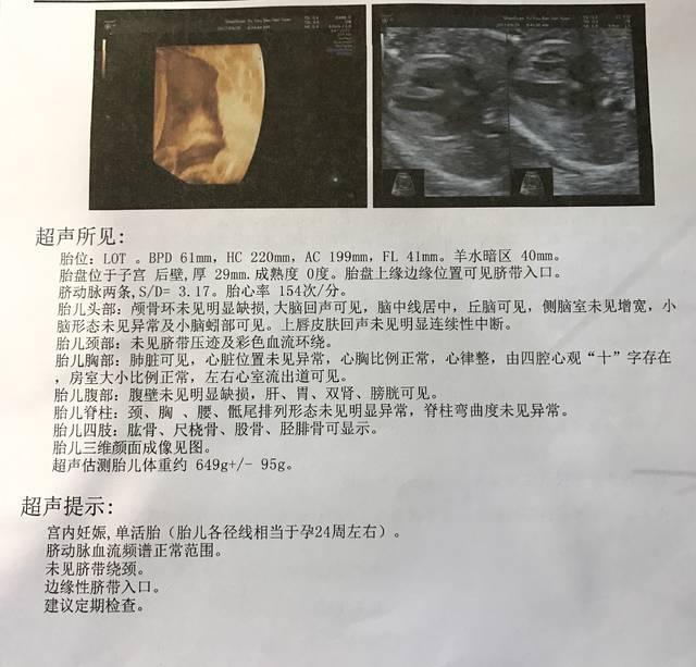 做四维怎样看清胎儿,做四维的时候能看到胎儿什么样