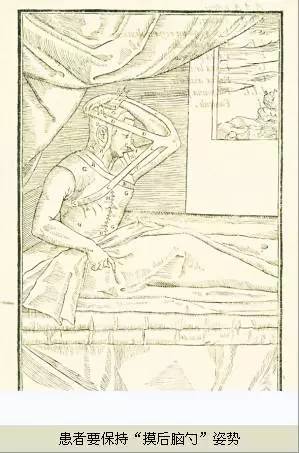 为什么明星做整形失败率更高,明星为什么不去正规整形医院