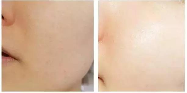 敷了就能白一个度的面膜推荐,敷上效果特别明显的面膜