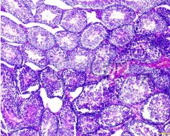 组织切片的优缺点,组织学切片处理过程