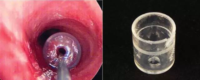 笔帽上的小孔能救命,笔帽上为什么有个小孔