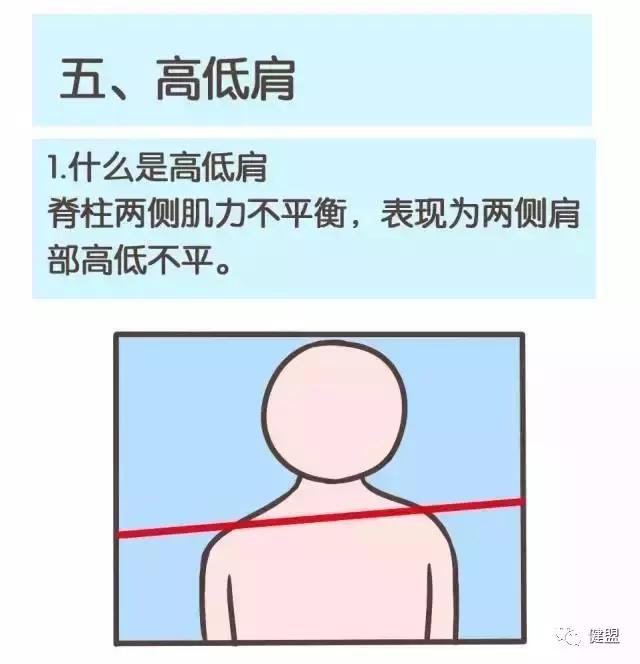 成年人驼背耸肩,一招拯救圆肩驼背