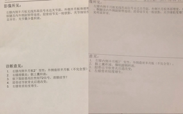 打羽毛球造成网球肘的原因,打羽毛球网球肘最快的自愈方法