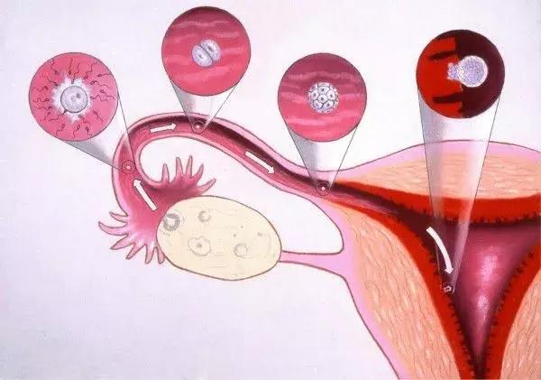 多个卵泡会导致不孕吗,多卵泡医生不建议备孕