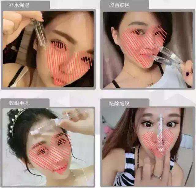 涂抹式水光针真的有用吗,涂抹式水光针能每天使用吗