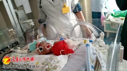 新生儿肾衰竭的预防措施,新生儿肾衰竭看病