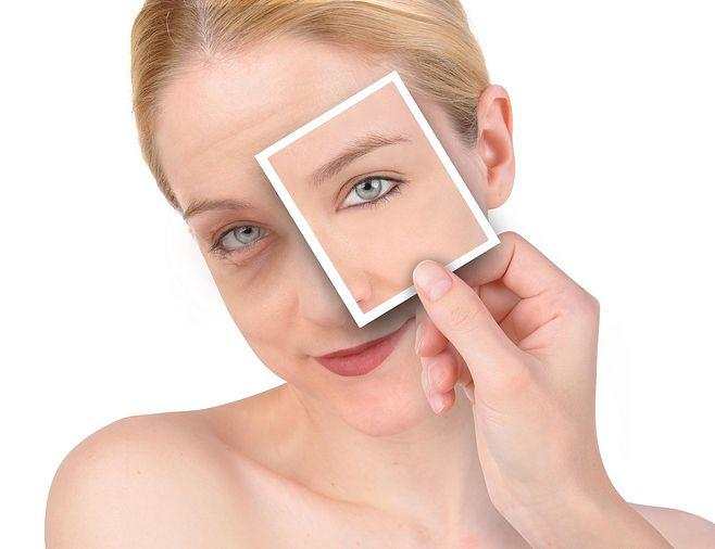 皮肤管理:假性眼纹的护理方法