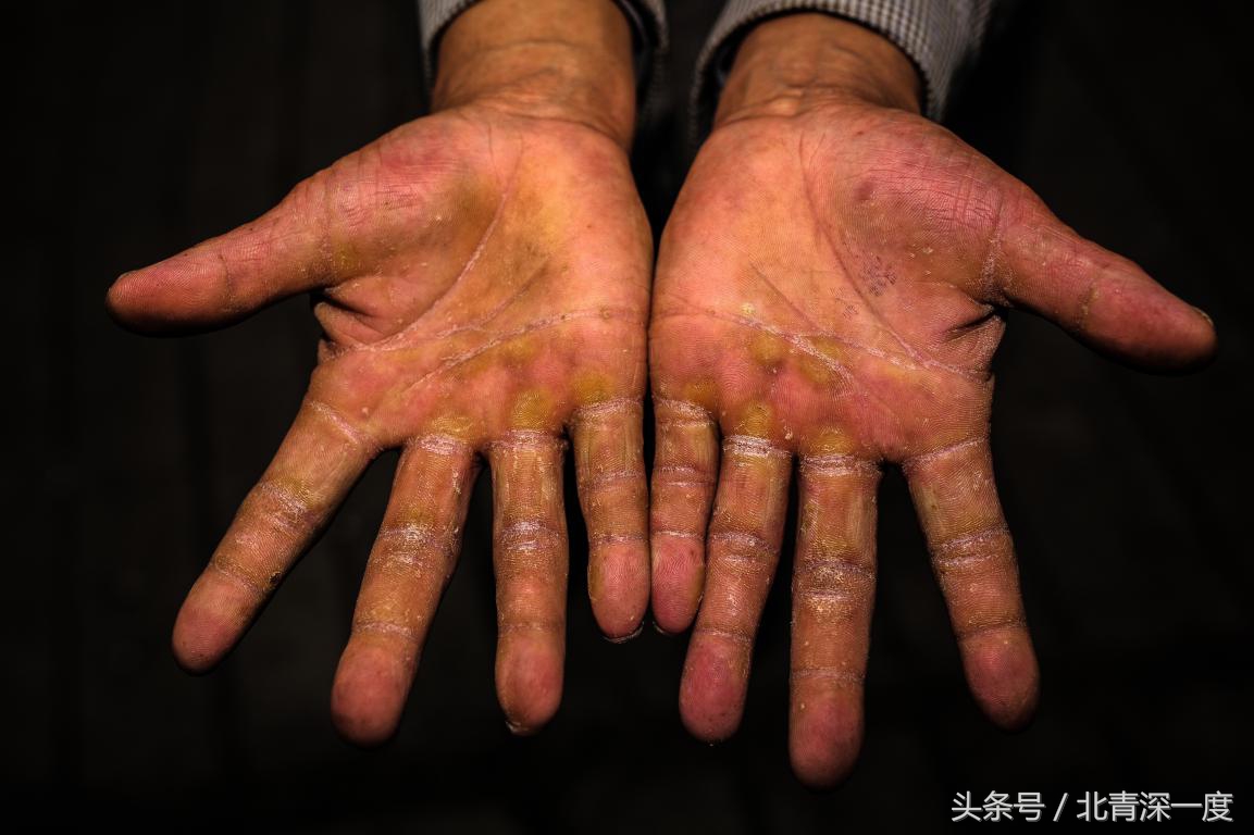 「看见」泥坑里的“鹿晗”和吃土豆的孩子：80张图，读懂中国脱贫