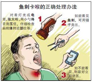 鱼刺卡喉两年多了喉咙有异物感,吃鱼鱼刺卡喉怎么办