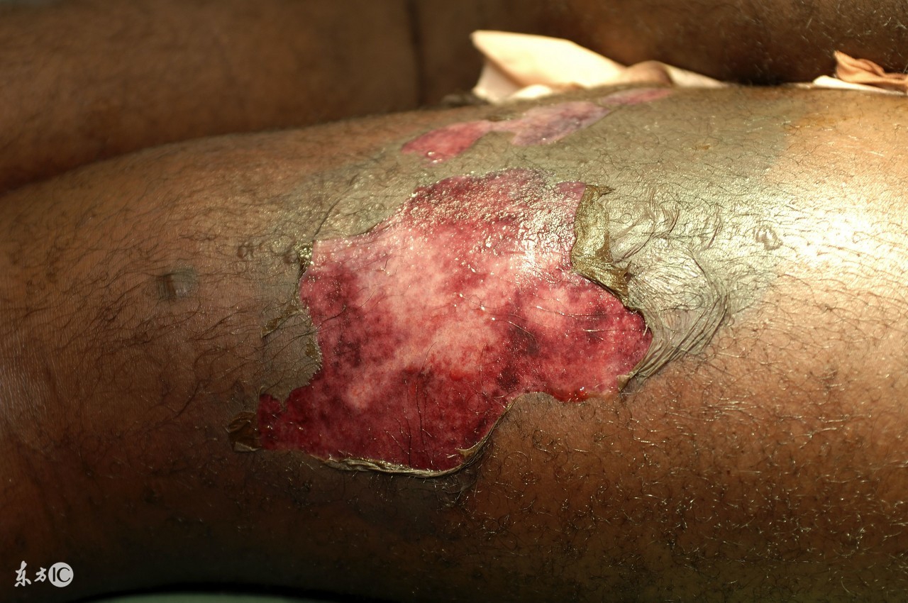 北京高新戒毒中心,北京高新医院戒毒治疗管用吗