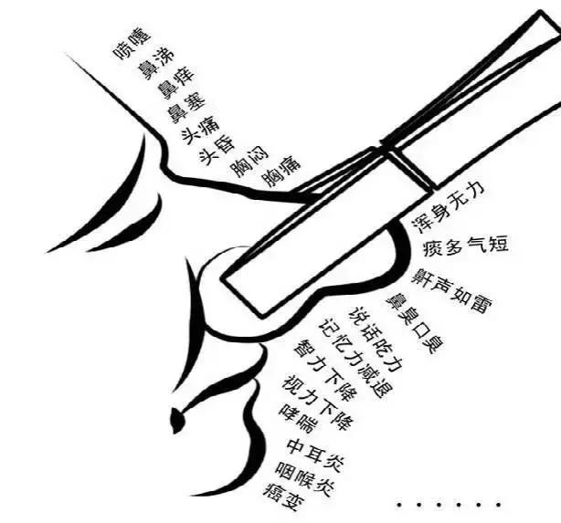 什么情况下需要做鼻窦炎手术,鼻窦炎要做微创手术吗