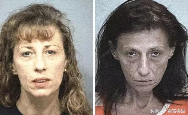 10个吸毒前后的惊人变化,吸毒的人吸毒前后对比图片