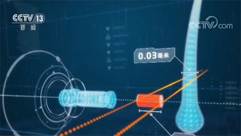肿瘤医疗新技术新项目大全,肿瘤新技术研究成功