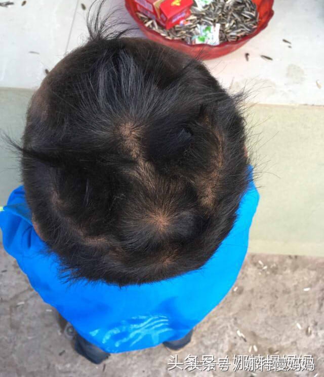 宝宝头旋歪了有啥说法,宝宝有两个头旋有什么说法