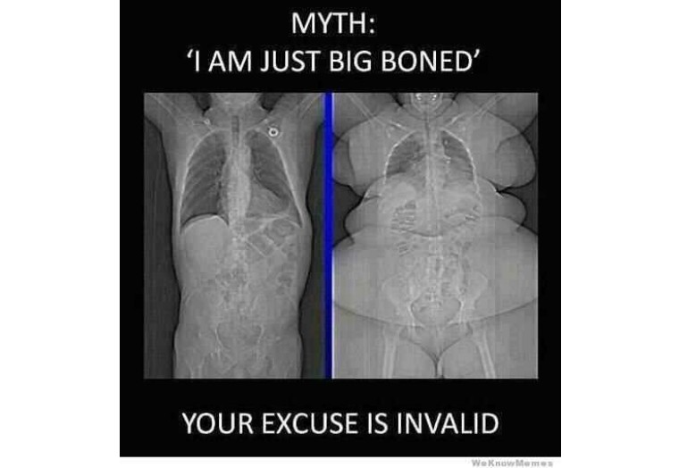 骨架大显胖,大骨架显瘦还是显胖