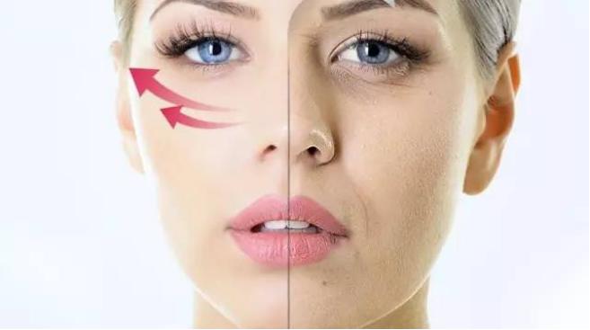 超声刀能去除法令纹吗,热玛吉祛法令纹好还是超声刀好