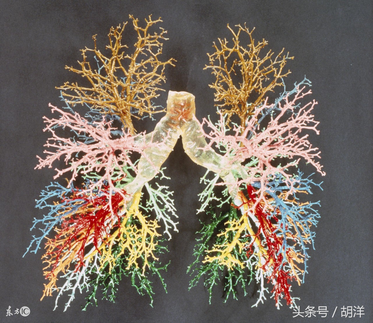 肺部肉芽肿和肿瘤几率各一半,肺上长脓包是个严重的病吗