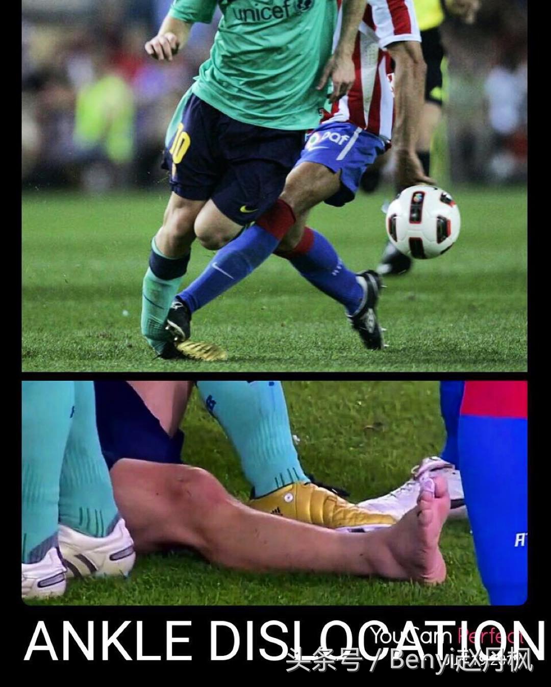 脚踝伤病的六个问题,脚踝受伤康复训练篮球