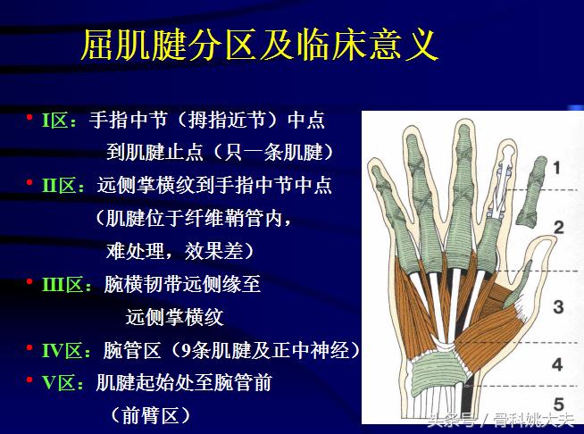 手肌腱损伤图片,手外伤神经肌腱损伤怎么定残