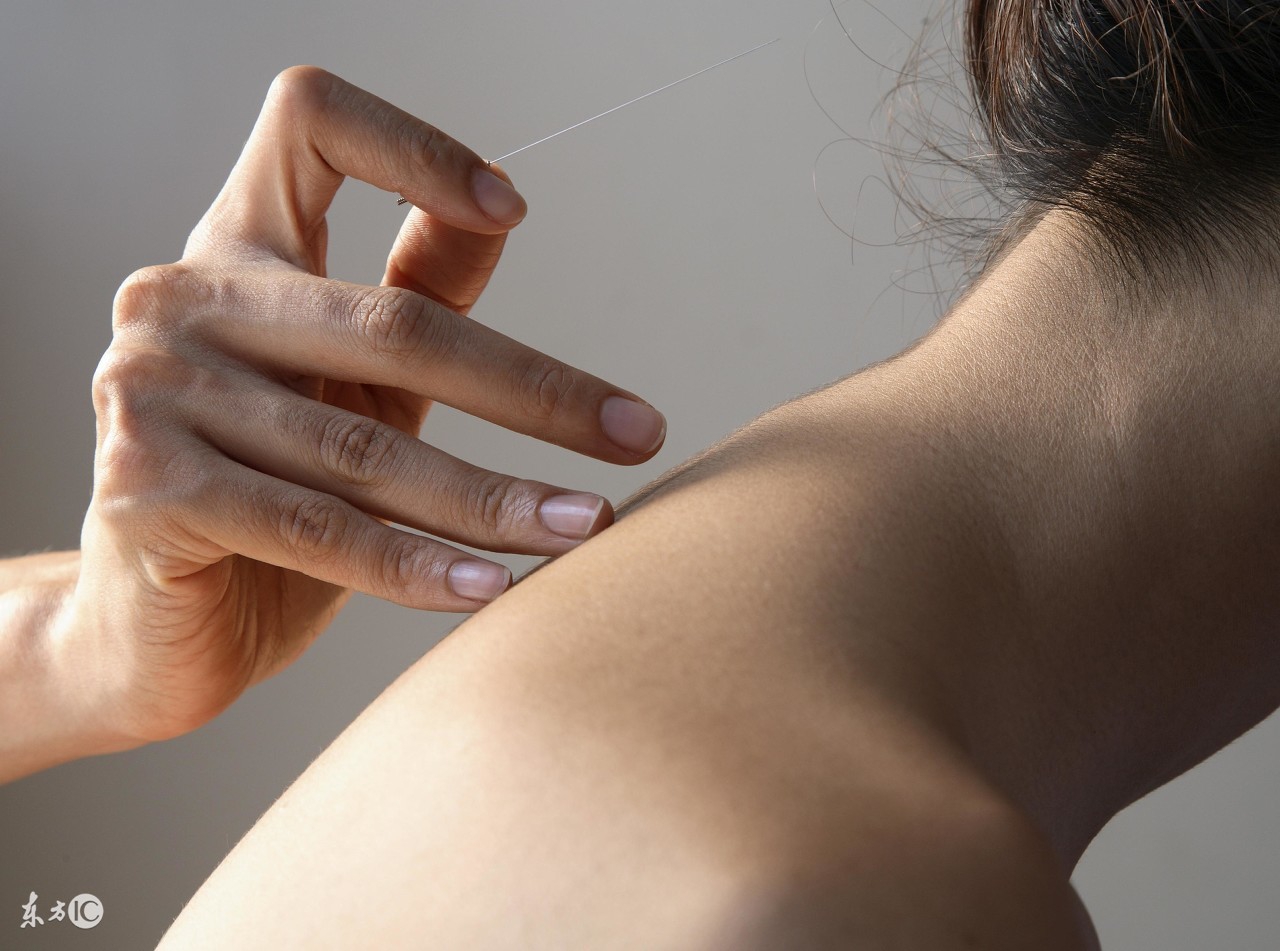 中医“萌新”的福利！针灸心得整理！