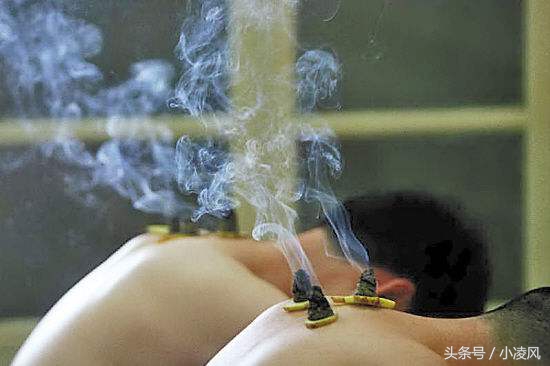 抑郁症艾灸禁忌与注意事项,手术后艾灸禁忌与注意事项