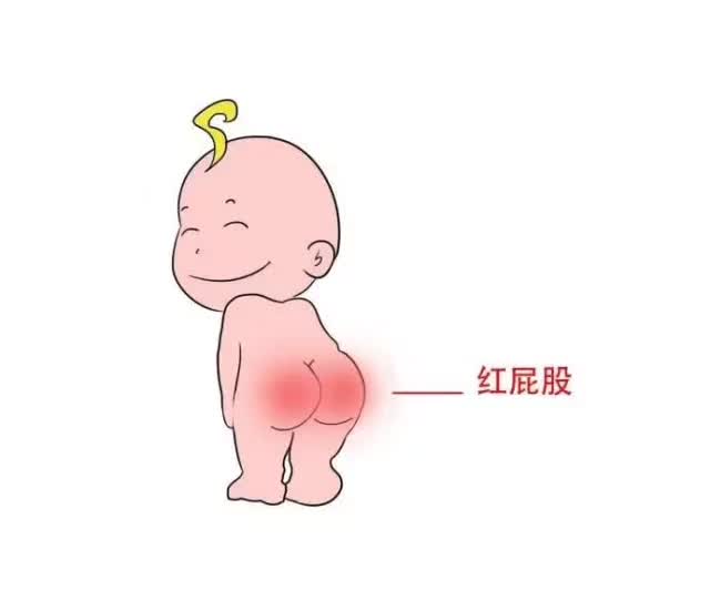 大白罐可以预防孩子红屁屁吗,预防红屁屁是擦油好还是擦粉好
