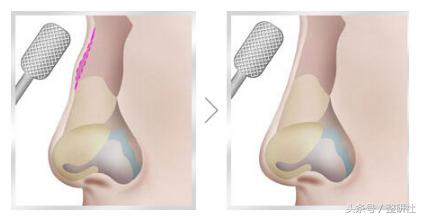 甜美少女养成,甜美养成记学生党